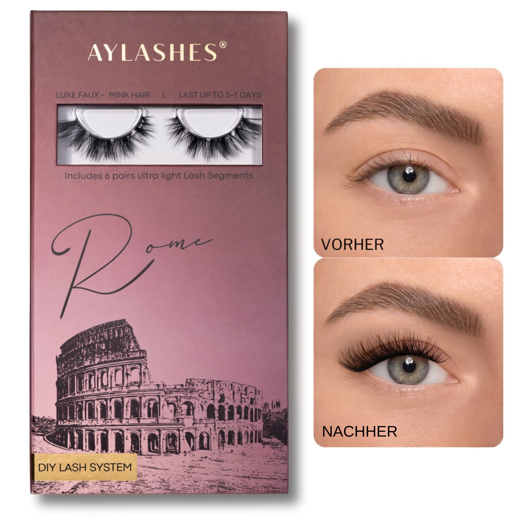 ROME (5mm - 16mm)